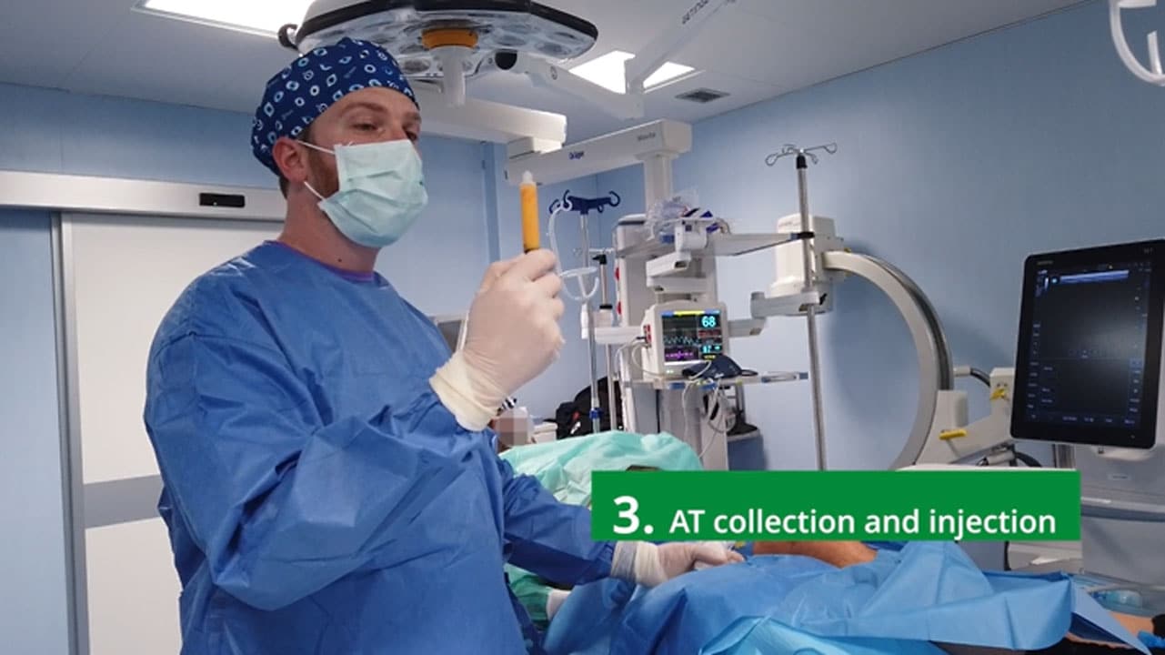 Live surgery: adipose tissue harvesting and reinjection